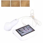 Skin Diagnosis Hair Analyzer, 5 Inch Lcd Screen Digital Detector Tester New. Price: $203.22.